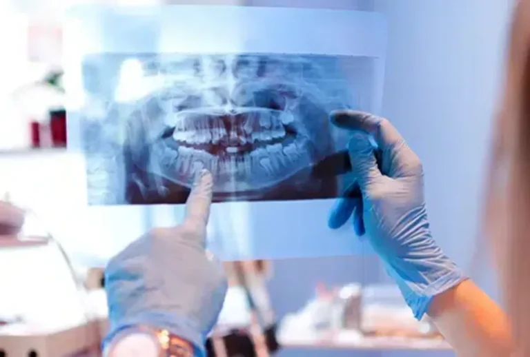 Gloved hands holding a panoramic dental X-ray up to the light