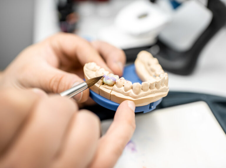 Dental technician glazing a crown on a stone model in the lab