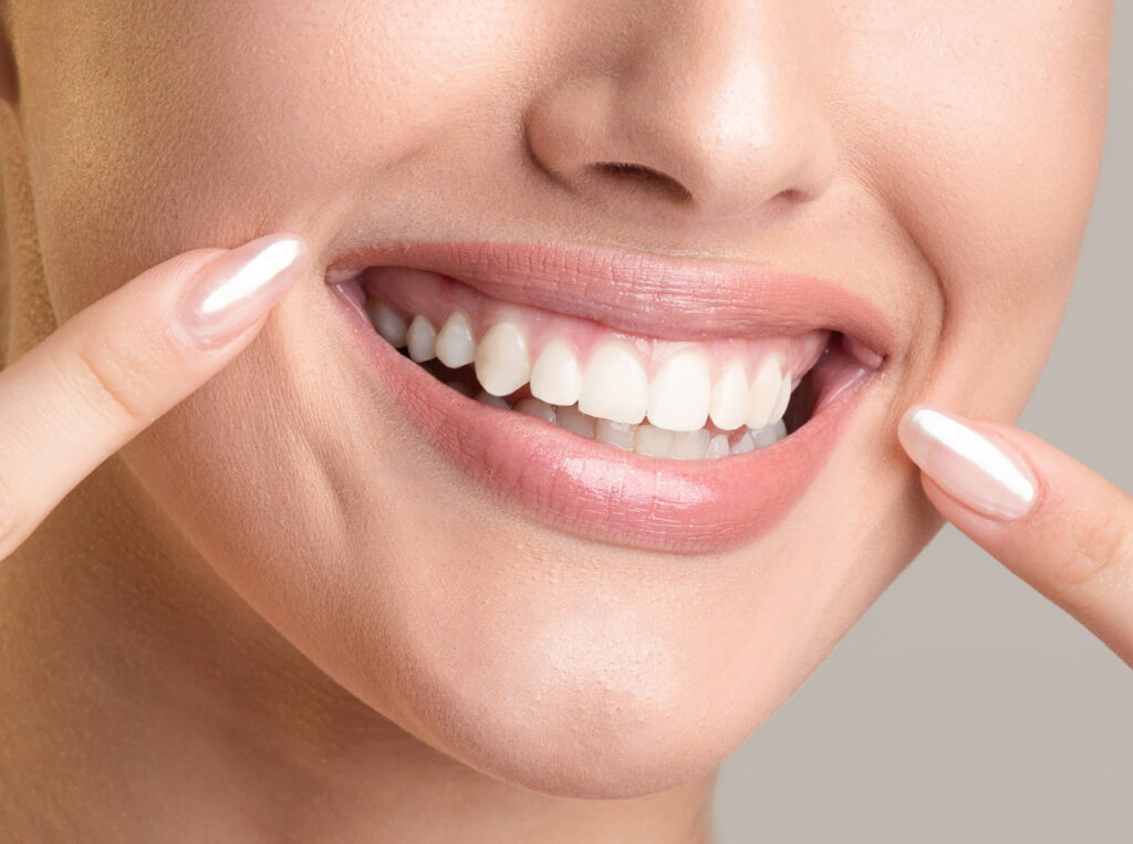 digital smile design