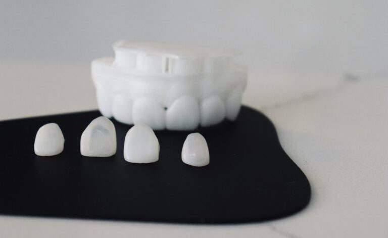 Four porcelain veneer shells in front of a white dental teeth model