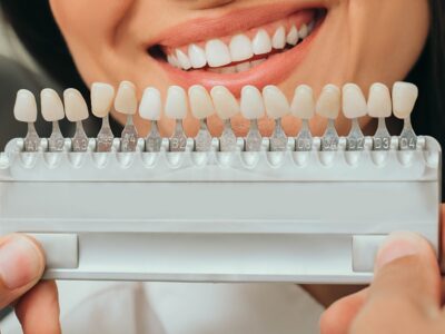 Porcelain veneer shade guide held in front of a smile to compare tooth colors